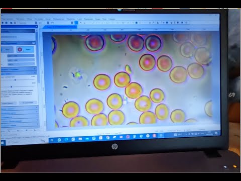 Видео: Что ОСИНА творит с телом / кровушка после сока из осины