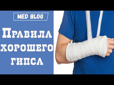 Видео: Правильно ли наложен гипс? | Боль и отек и онемение при ношении гипса |  Когда гипс нужно поменять?