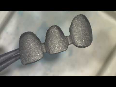 Видео: Передопак