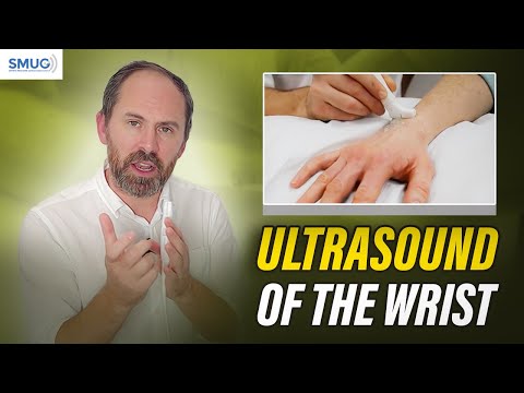 Видео: УЗИ запястья — полное руководство!
