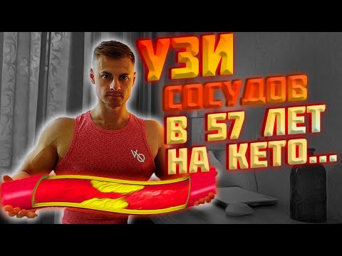 Видео: УЗИ сосудов в 57 лет на КЕТО...