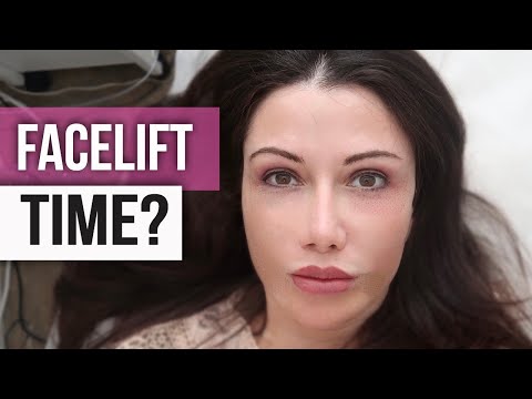 Видео: До и после подтяжки лица: молодые