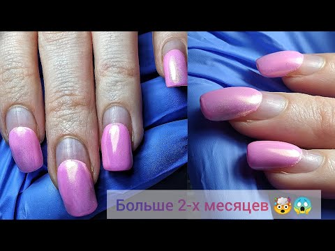 Видео: НУ И КАК ТАК МОЖНО ДЕЛАТЬ😱 ПЕРЕНОШЕННЫЕ НОГТИ😍