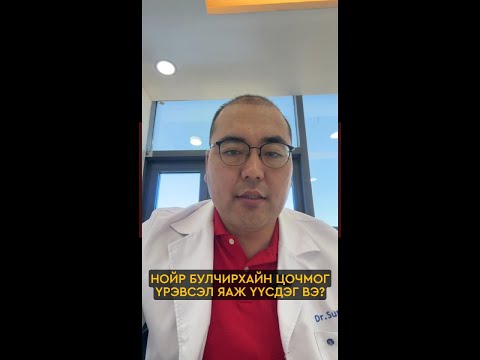 Видео: 2507.Нойр булчирхайн цочмог үрэвсэл яаж үүсдэг вэ? #shorts