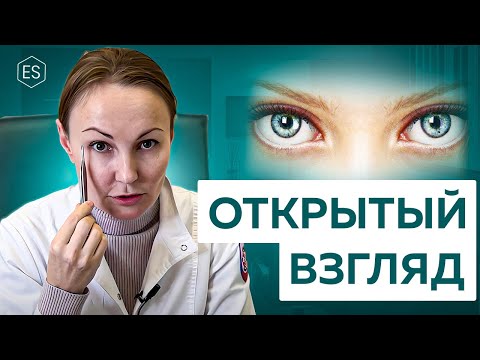 Видео: 👁 Как сделать ВЗГЛЯД ОТКРЫТЫМ? Почему ОПУСКАЮТСЯ ВЕКИ на глаза? ЭНДОСКОПИЯ или ПЛАСТИКА ВЕРХНИХ ВЕК?