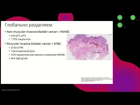 Видео: Подготовка к экзамену ESMO.  Рак мочевого пузыря (вебинар 1 сентября 2024)