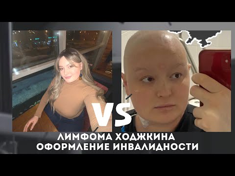 Видео: Как оспорить группу инвалидности?/Лимфома Ходжкина 2 стадия