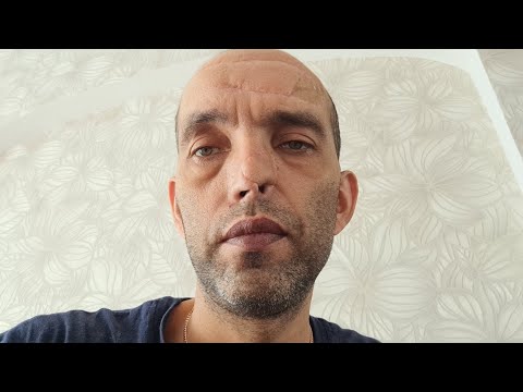 Видео: Ошибка гистологии онкодиспансера в г.Красноярске !?