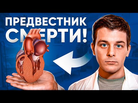 Видео: Гипертрофия левого желудочка сердца (ГЛЖ) | Что нужно знать!