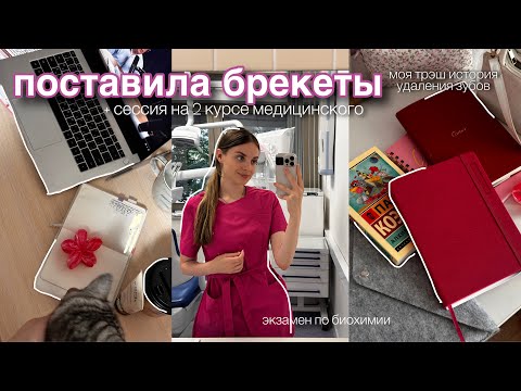 Видео: я поставила брекеты *моя история лечения зубов* + летняя сессия в медицинском🦷