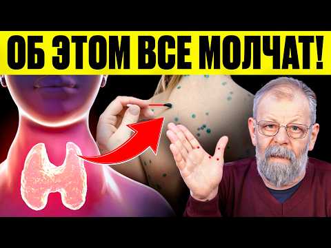 Видео: Бойтесь как огня. Мифы о щитовидке и гормонах
