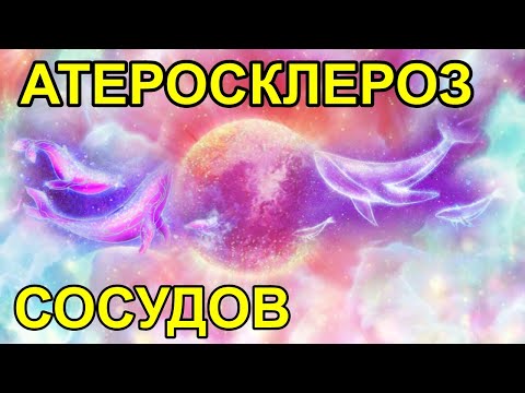 Видео: Почему болят ноги? Диагностика атеросклероза сосудов.