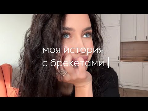 Видео: моя история с брекетами // Я ПОПАЛА В БОЛЬНИЦУ?