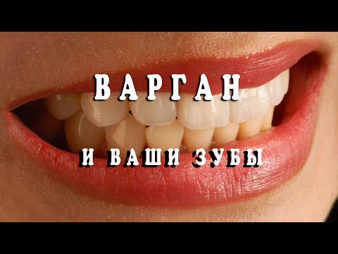 Видео: Варган и ваши зубы