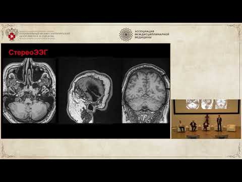 Видео: Эпилепсия 2023. Дело 1: Знак четырех