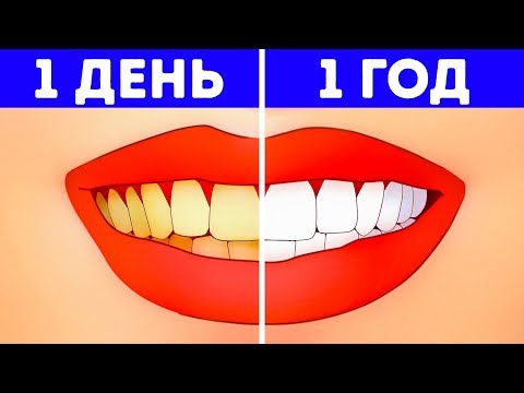 Видео: Что Будет, Если Не Чистить Зубы Год?