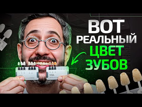 Видео: Какого цвета должны быть здоровые зубы? Ответ вас удивит