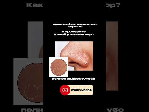 Видео: Вертикальные Поры, Что это? и почему это так страшно?