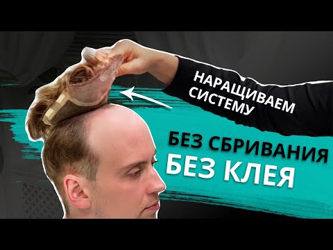 Видео: Мужская система волос без сбривания и без клея на коже.