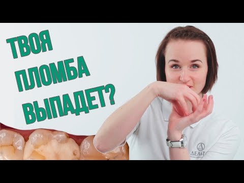 Видео: Почему ПЛОМБА не должна выпадать? (Школа здоровых зубов)