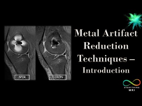 Видео: Методы уменьшения металлических артефактов — Введение