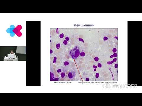 Видео: Морфология клеток костного мозга и периферической крови  Пункционная диагностика