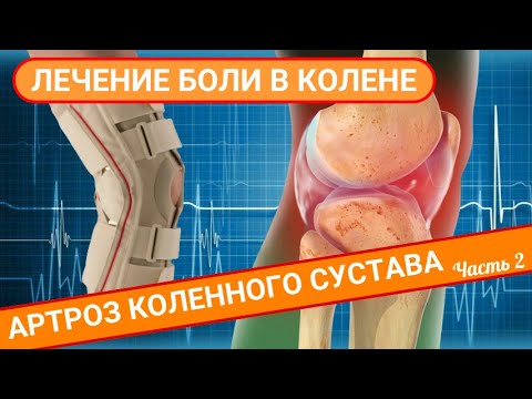 Видео: ЛЕЧЕНИЕ БОЛИ В КОЛЕНЕ. Артроз коленного сустава (Часть 2)
