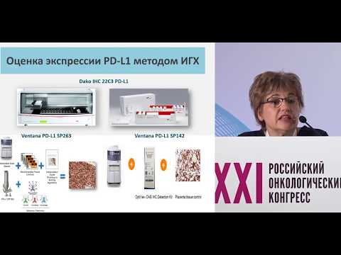 Видео: Тестирование PD-L1 у больных уротелиальным раком (первое крупное исследование в мире)