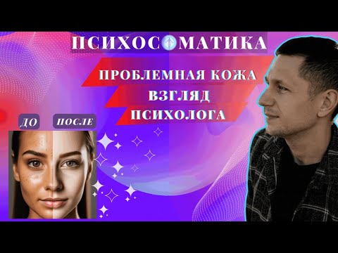 Видео: Проблемная кожа. Акне, угри, прыщи, высыпания, раздражения. Взгляд психолога