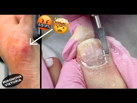 Видео: Мой ужасный педикюр😢/ Так делать нельзя!!!