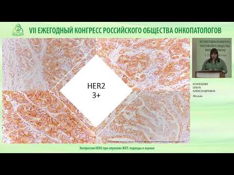 Видео: Экспрессия HER2 при опухолях ЖКТ – подходы к оценке