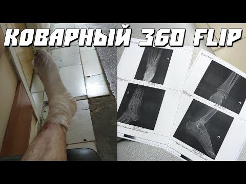 Видео: Иногда не все идет по плану. 360 flip. ТРЮК ЗА МЕСЯЦ#3