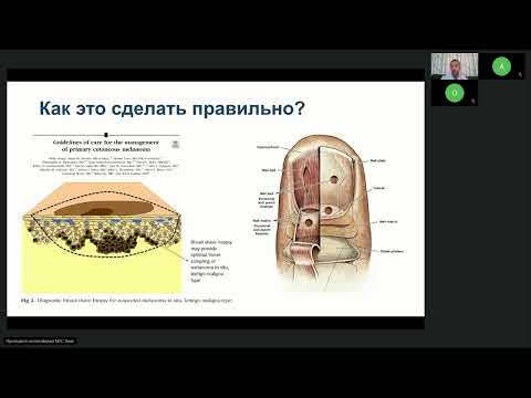 Видео: Меланома (вебинар 20 октября 2023)