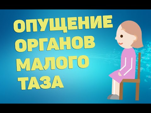 Видео: Опущение органов малого таза | ЛФК