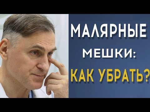 Видео: МАЛЯРНЫЕ МЕШКИ: КАК УБРАТЬ? ❗️❗️❗️