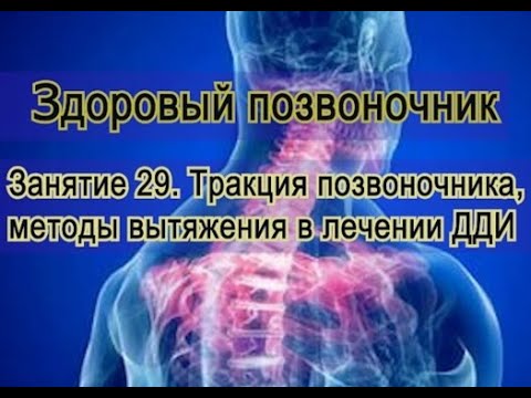 Видео: Занятие 29. Вытяжение (тракция) больного позвоночника при ДДИ