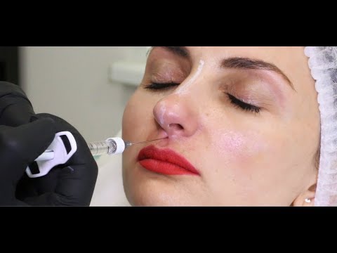 Видео: Видео. Мастер-класс Елены Байбариной. Коррекция формы носа.
