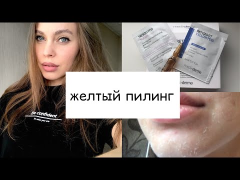 Видео: Желтый пилинг/ Моя история /Почему я делаю пилинг дома
