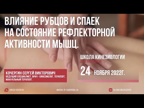 Видео: #17 Школа Кинезиологии. Влияние рубцов и спаек на состояние мышц. 24 ноября 2022г