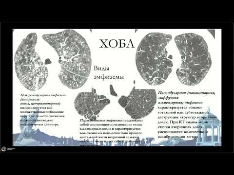 Видео: КТ легких болезни ассоциированные с курением