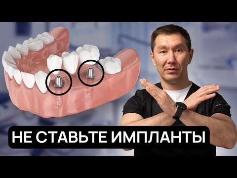 Видео: Не ставьте импланты, пока не узнаете это! Стоматологи не договаривают