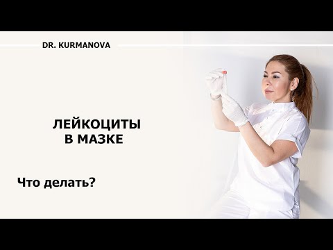 Видео: Обнаружили лейкоциты в мазке?! Что делать? Лечить или нет??