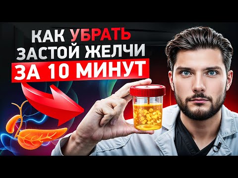 Видео: 5 последствий застоя желчи. Как сбросить желчь и запустить работу организма!