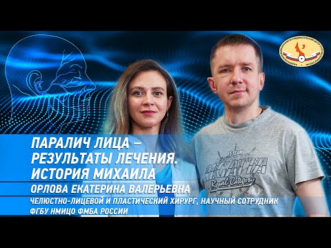 Видео: Паралич лица - результаты лечения. История Михаила