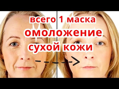 Видео: Минус 10-15 Лет ! Маска От Глубоких Морщин. Омоложение Сухой Кожи Лица