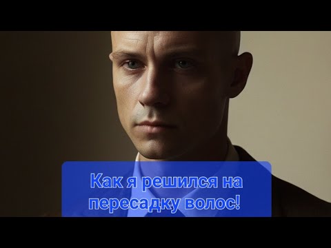 Видео: Пересадка волос в Москве. Как я решился на пересадку. У кого сделал пересадку/  Количество графтов