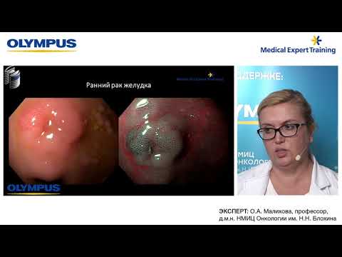 Видео: ЭКСПЕРТНЫЙ ВЕБИНАР "ТРУДНОСТИ В ДИФФЕРЕНЦИАЛЬНОЙ ДИАГНОСТИКЕ ОПУХОЛЕЙ ПИЩЕВОДА И ЖЕЛУДКА"