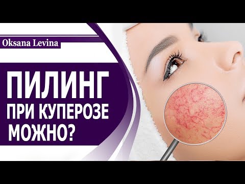 Видео: КУПЕРОЗ. КАКОЙ ПИЛИНГ МОЖНО ДЕЛАТЬ ПРИ КУПЕРОЗЕ И РОЗАЦЕА