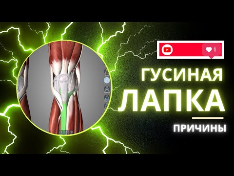 Видео: Гусиная лапка. Причины и возможные решения. Часть первая.