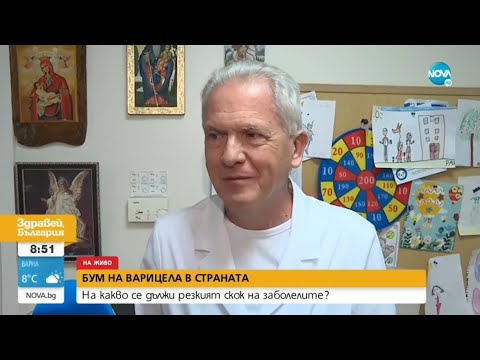 Видео: Обрив и температура – сред първите симптоми на варицела при децата